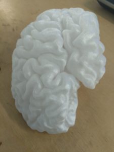 impression 3D du scan 3D (IRM) d'un vrai cerveau humain